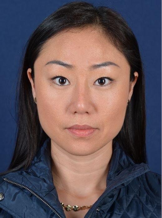 A result from Egrari Plastic Surgery & Non Invasive Center