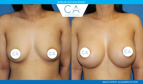 CA Aesthetics: Bay Area Plastic Surgery Eric Li, MD provider photo