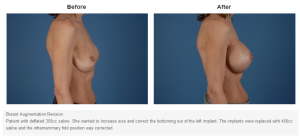 A result from Bradley Hubbard, MD