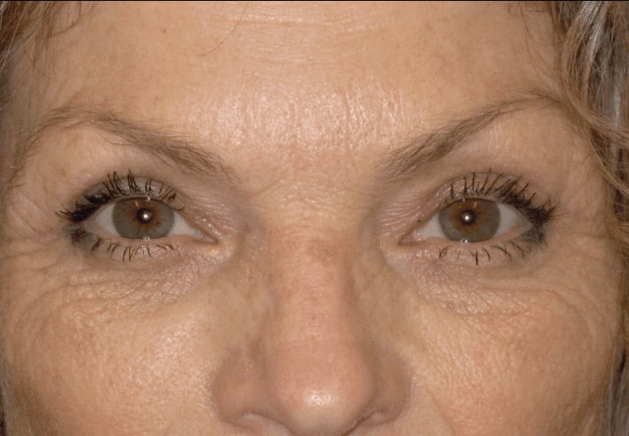A result from Kramer Plastic Surgery