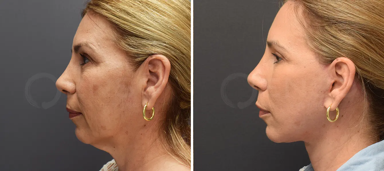 A result from Dr. Paul Durand, MD