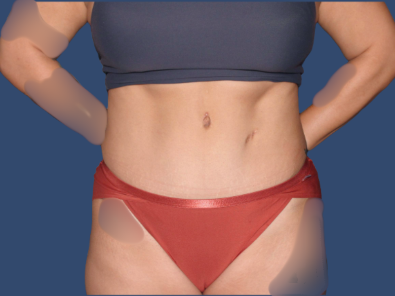 Hill Country Plastic Surgery provider photo
