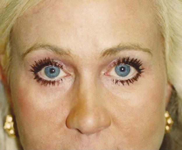 A result from Weston Cosmetic Surgery