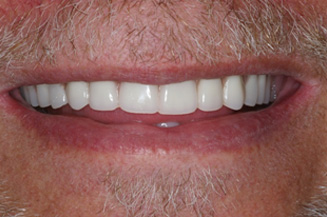 OC Dental Specialists | Emergency & Cosmetic Dentist Irvine provider photo