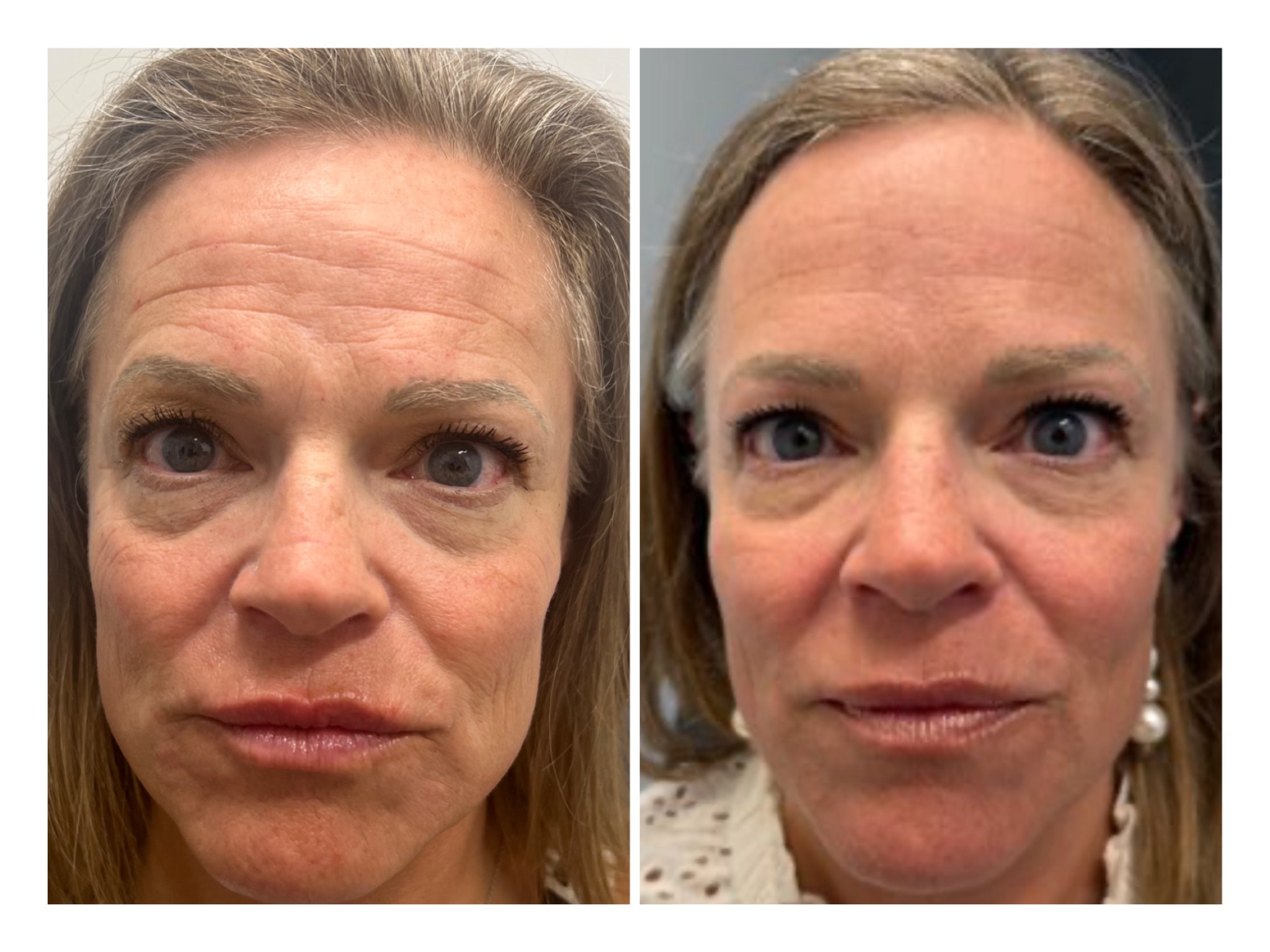 A result from Arlani Integrative Medicine and Medspa