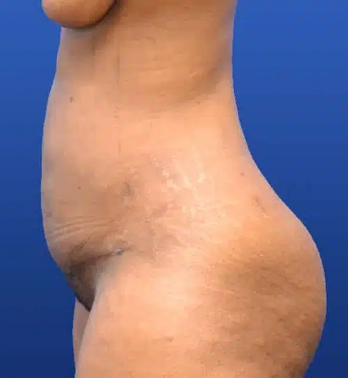 Georgia Plastic & Reconstructive Surgery provider photo