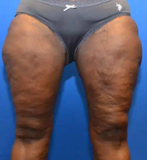 Georgia Plastic & Reconstructive Surgery provider photo
