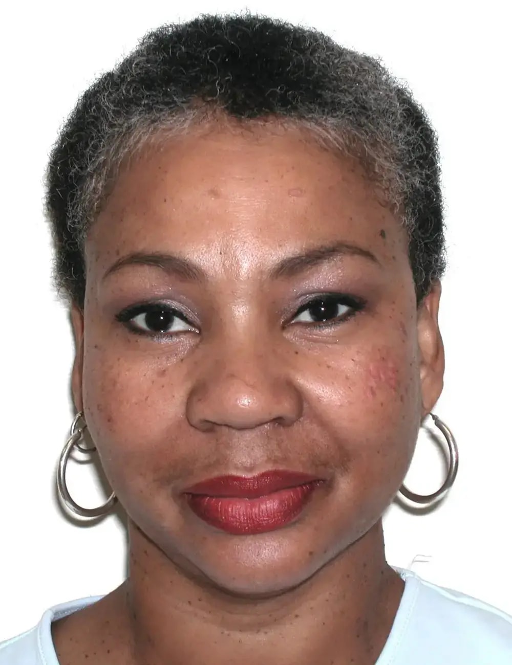A result from J. Brian Boyd, MD