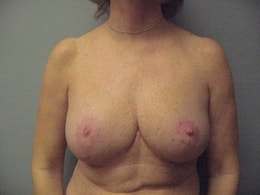 A result from Wandra K. Miles, MD