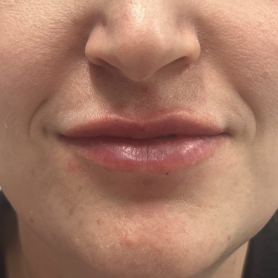 A result from Pure Envy Med Spa
