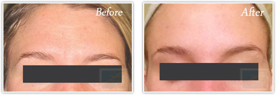 A result from Lupo Center for Aesthetic and General Dermatology