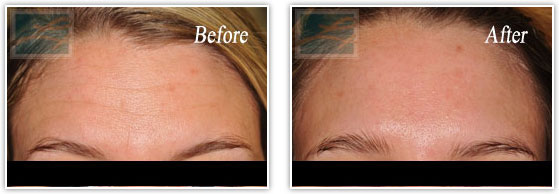 A result from Lupo Center for Aesthetic and General Dermatology