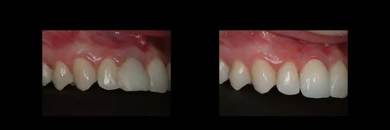 A result from The Dental Studio