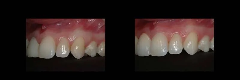 A result from The Dental Studio