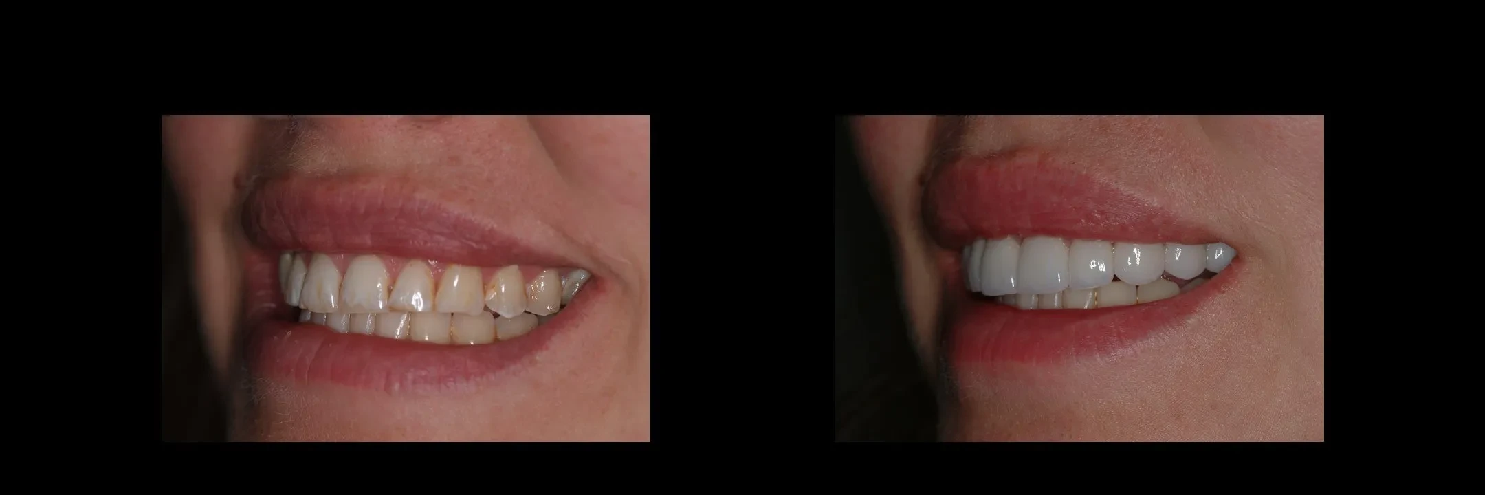 A result from The Dental Studio