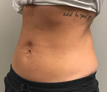 A result from The Skin Center