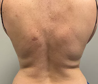 A result from The Skin Center
