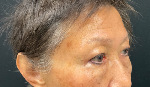 A result from Leyngold Institute for Plastic Surgery