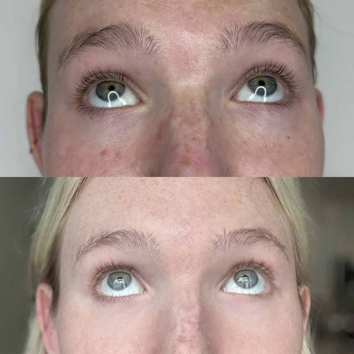 A result from KDR MedSpa + Wellness