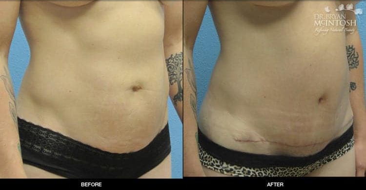 A result from Refine MD, Northwest