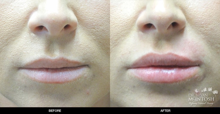 A result from Refine MD, Northwest