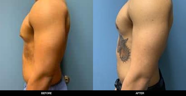 A result from Refine MD, Northwest