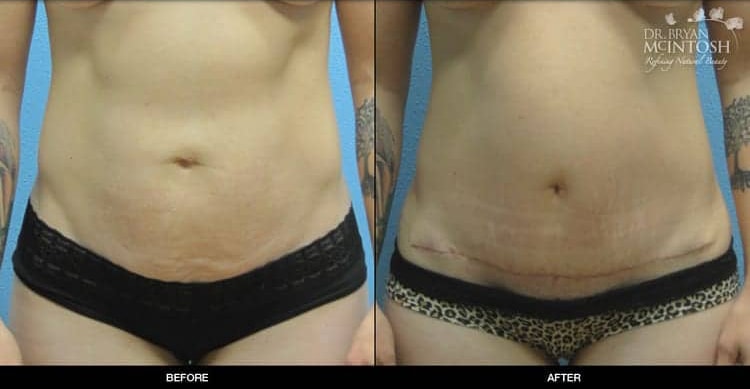 A result from Refine MD, Northwest