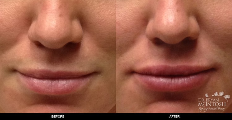 A result from Refine MD, Northwest