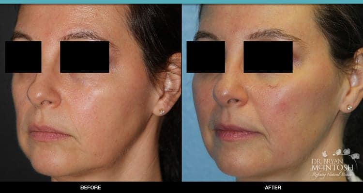 A result from Refine MD, Northwest