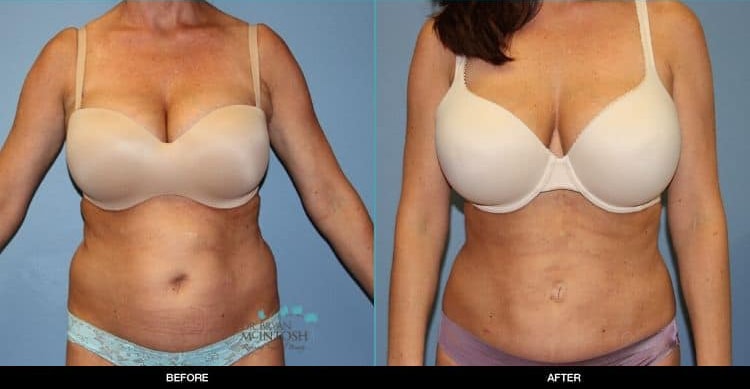 A result from Refine MD, Northwest