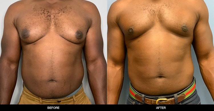 A result from Refine MD, Northwest