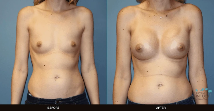 A result from Refine MD, Northwest