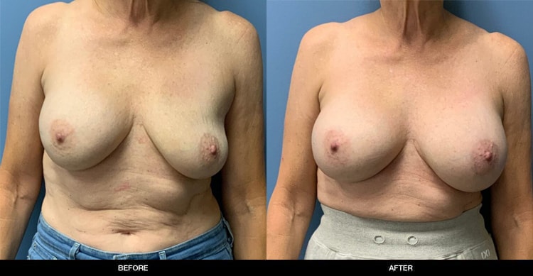 A result from Refine MD, Northwest