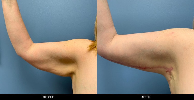 A result from Refine MD, Northwest