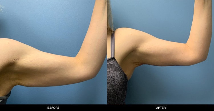 A result from Refine MD, Northwest