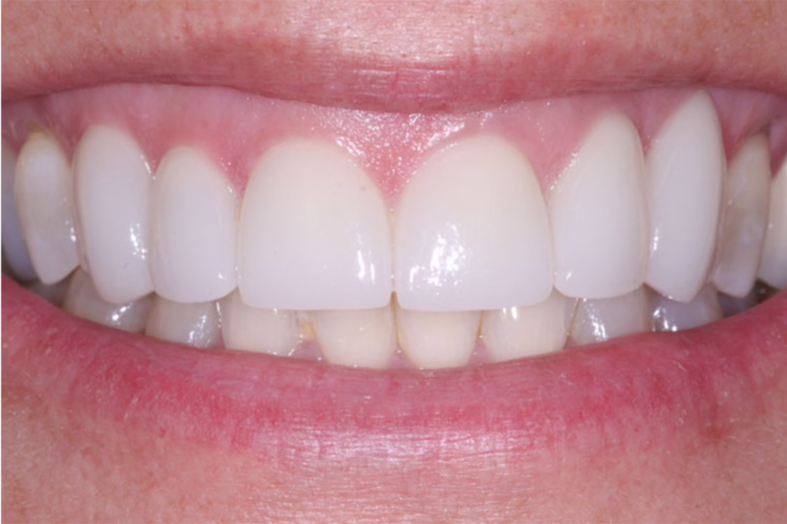 A result from The Dentistry Collective