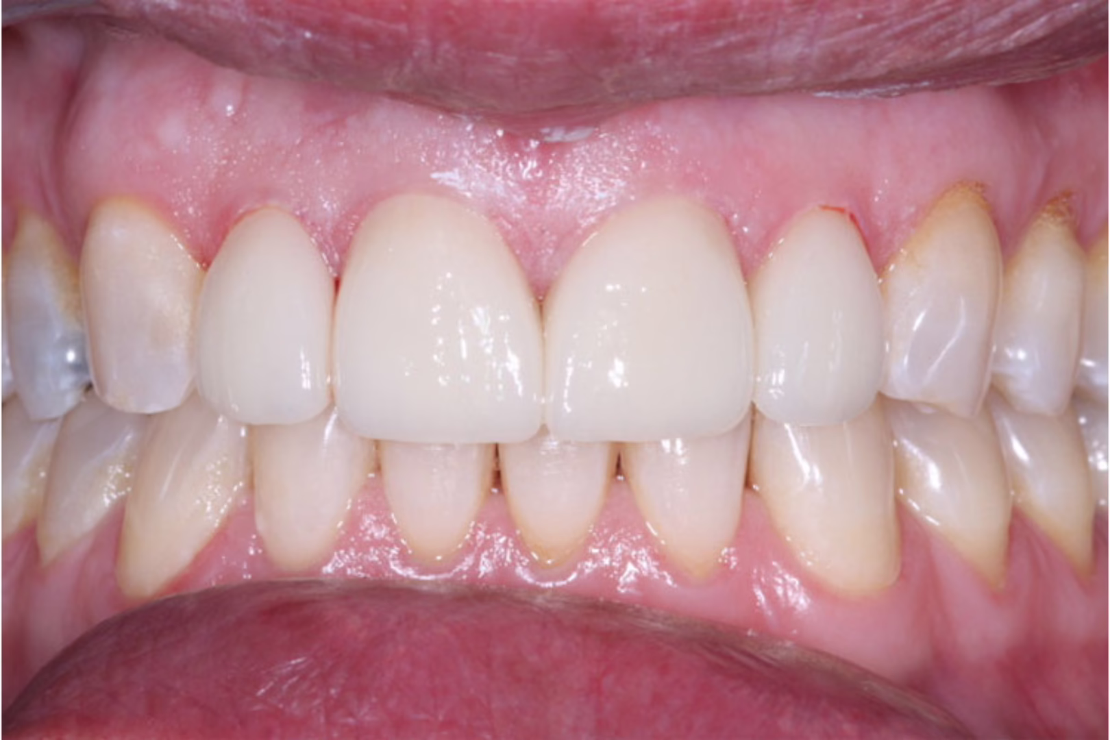 A result from The Dentistry Collective