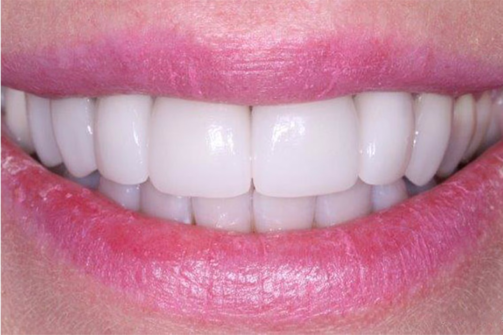 A result from The Dentistry Collective