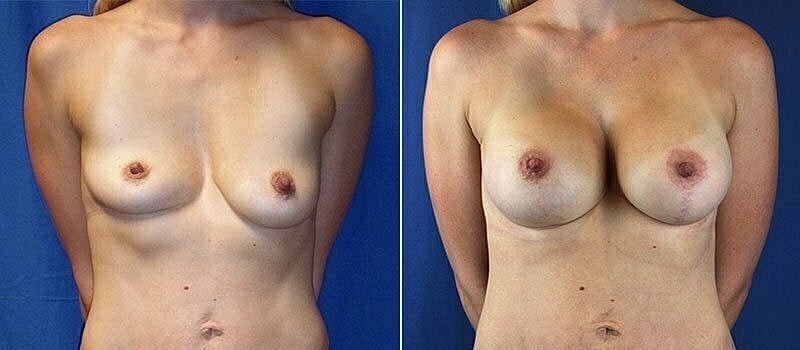 A result from Beauty by Buford (Gregory A. Buford, MD)