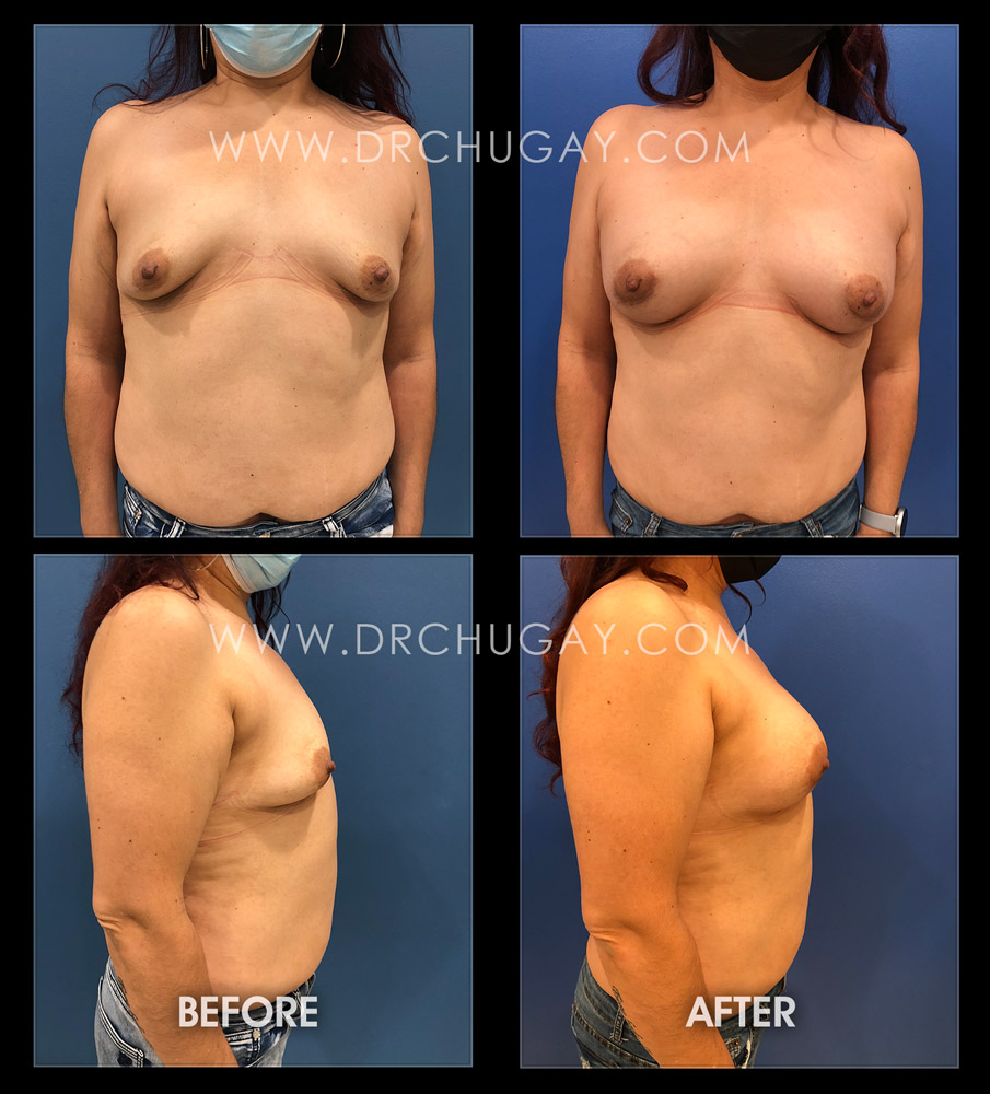 A result from Dr. Chugay