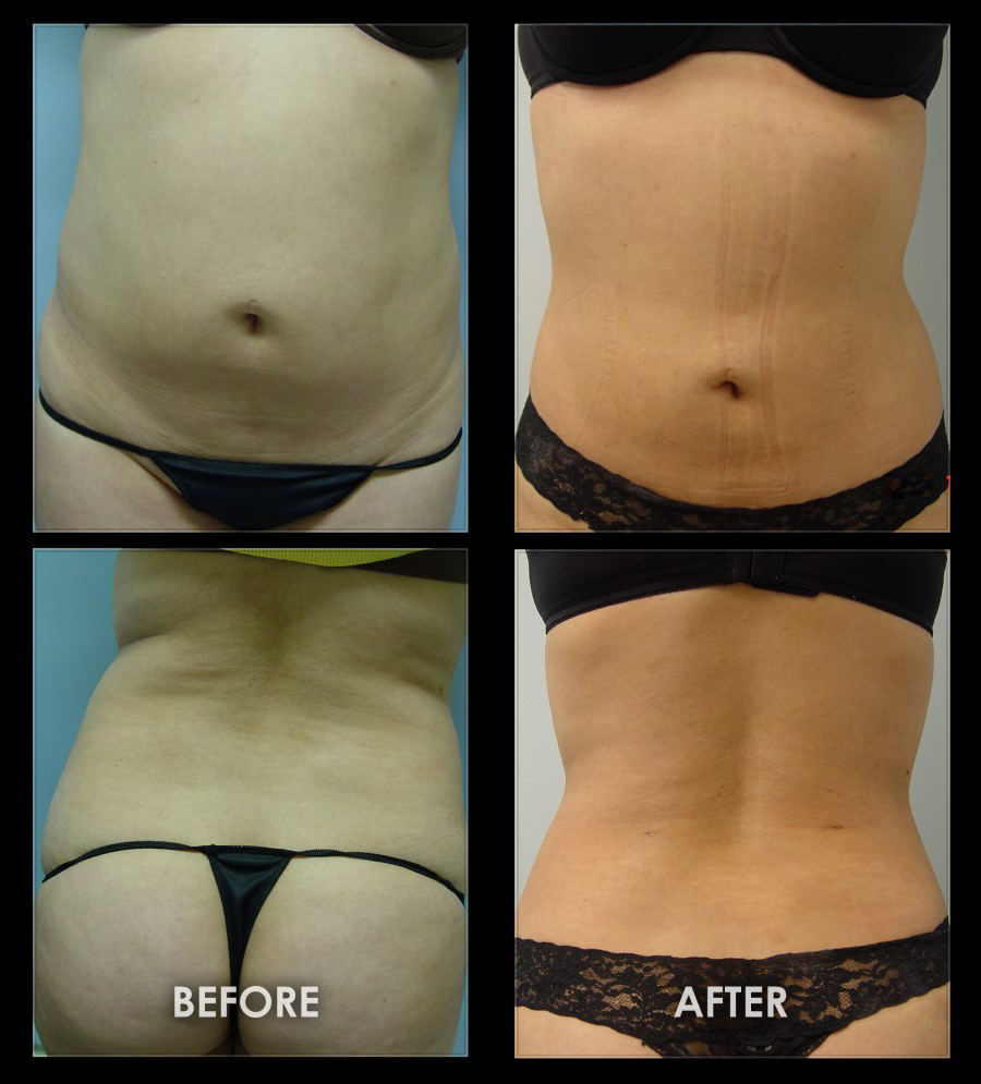 A result from Dr. Chugay