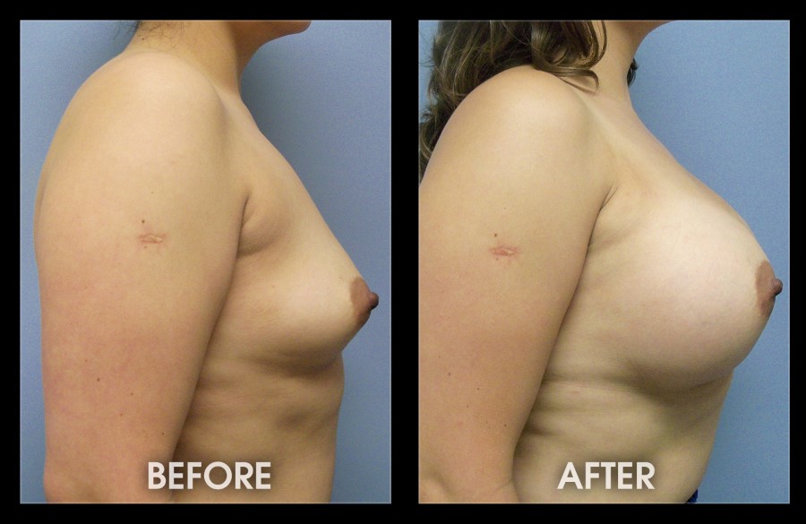 A result from Dr. Chugay