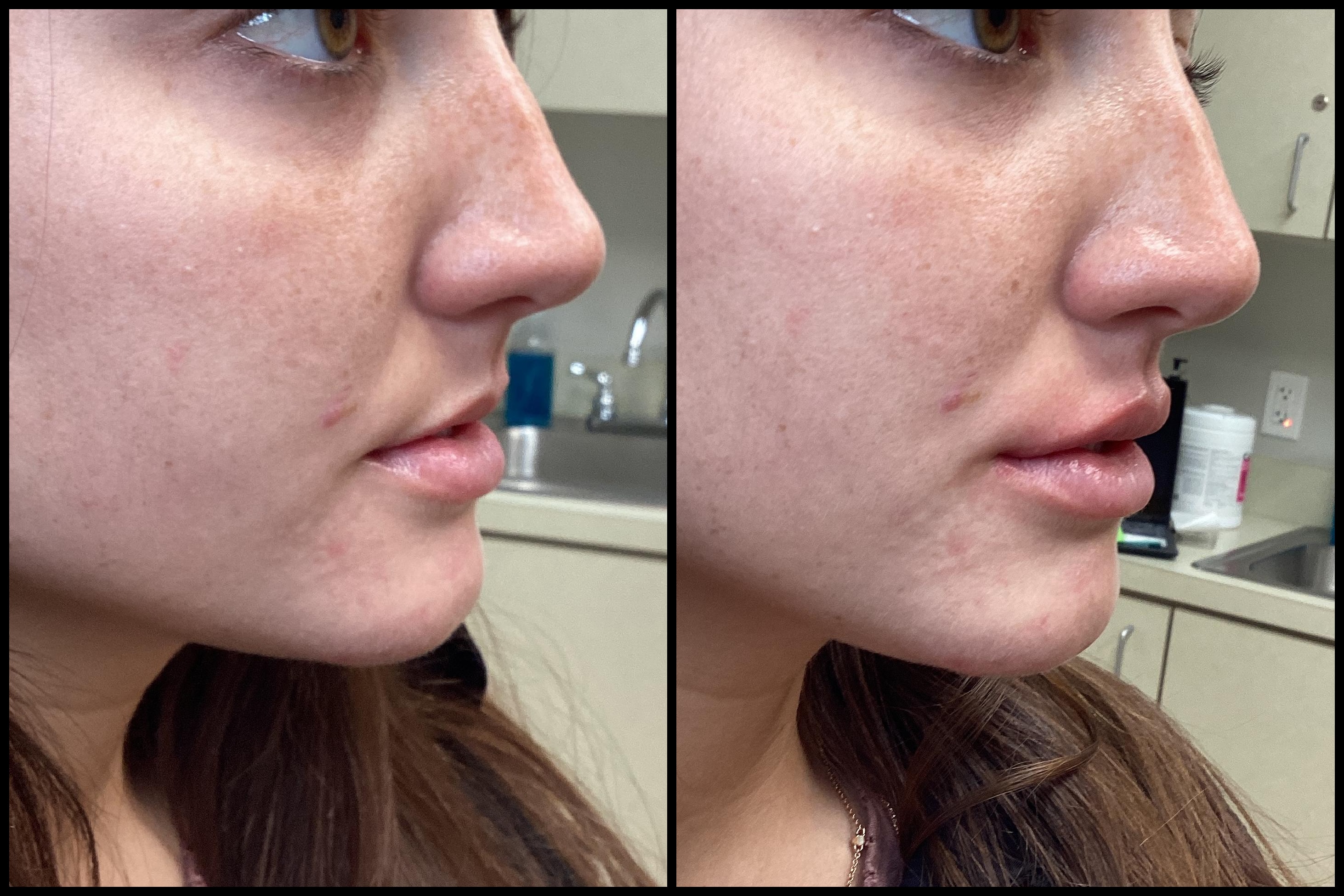 A result from Seiler Skin