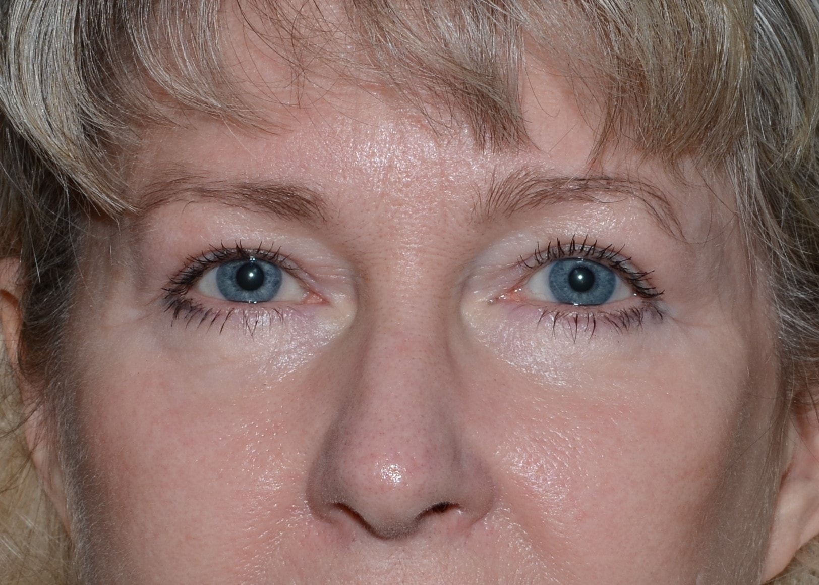 A result from Amadi Aesthetics Plastic Surgery