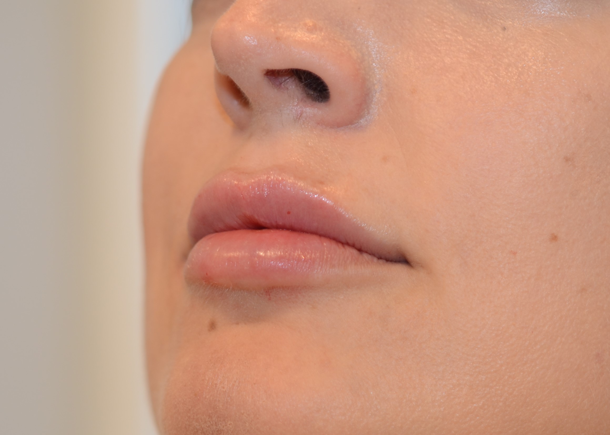 A result from Amadi Aesthetics Plastic Surgery