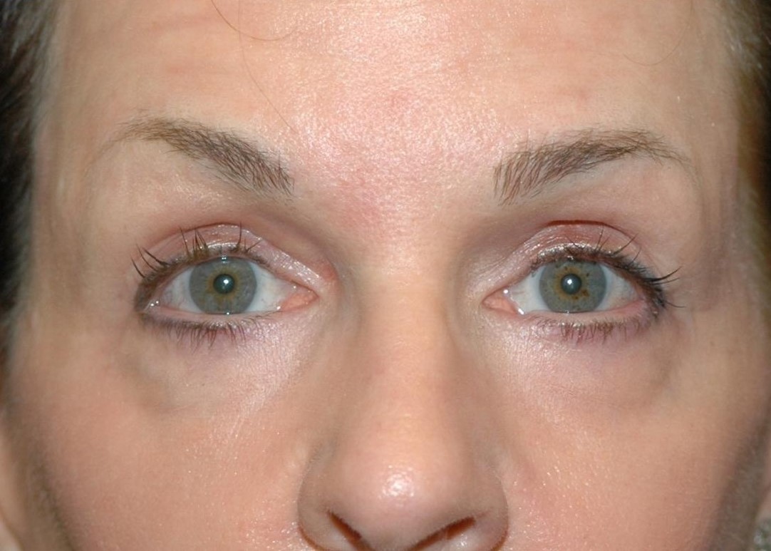 A result from Amadi Aesthetics Plastic Surgery