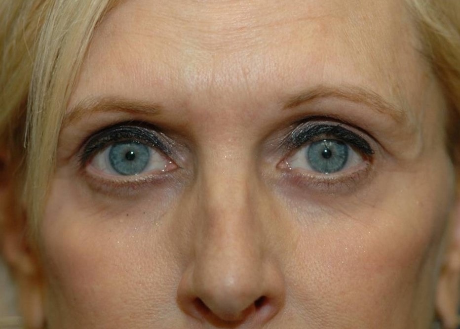 A result from Amadi Aesthetics Plastic Surgery
