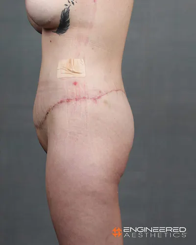 Procedure before photo