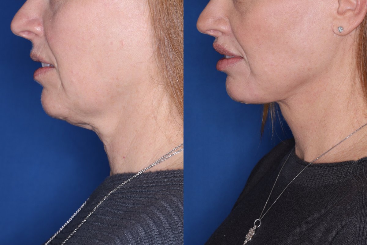 Kalos Facial Plastic Surgery provider photo