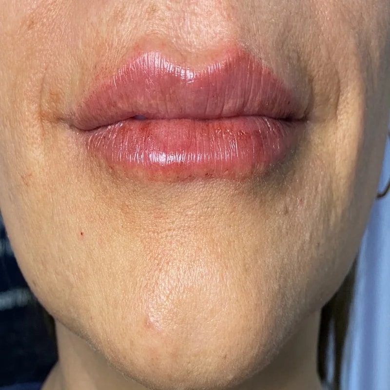 A result from Integracare Medical care and Aesthetics